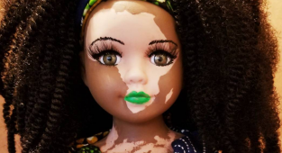 Artist creates dolls with vitiligo for children with rare skin disease (10 photos)