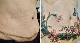 25 татуировок для перекрытия шрамов и других дефектов на теле (27 фото)